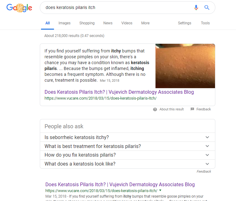 featured-snippet-number-one-in-SERP